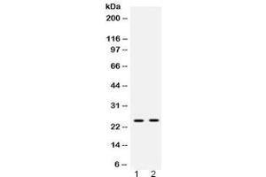 Western blot testing of 1) rat liver and 2) human placenta lysate with HMGB2 antibody at 0. (HMGB2 抗体)