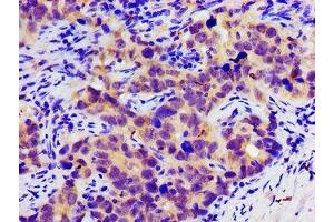 Immunohistochemistry (IHC) image for anti-Solute Carrier Family 25 (Mitochondrial Carrier, Aralar), Member 12 (Slc25a12) (AA 202-317) antibody (ABIN7146350)