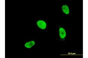 Immunofluorescence of monoclonal antibody to HOXA5 on HeLa cell. (HOXA5 抗体  (AA 171-270))