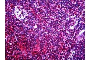 Human Thymus: Formalin-Fixed, Paraffin-Embedded (FFPE)