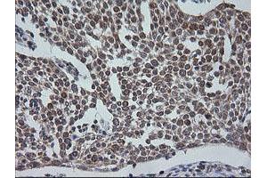Image no. 9 for anti-V-Ets Erythroblastosis Virus E26 Oncogene Homolog 2 (ETS2) (AA 90-349) antibody (ABIN1491702)