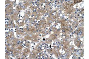Image no. 1 for anti-Zinc Finger Protein 81 (ZNF81) (C-Term) antibody (ABIN202859) (ZNF81 抗体  (C-Term))