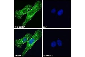 ABIN185467 Immunofluorescence analysis of paraformaldehyde fixed U2OS cells, permeabilized with 0. (SCN5A 抗体  (Internal Region))