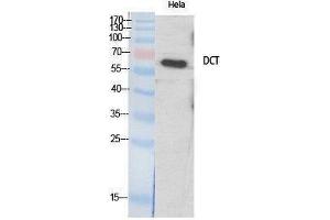 Western Blotting (WB) image for anti-Dopachrome Tautomerase (DCT) (Internal Region) antibody (ABIN3187350) (DCT 抗体  (Internal Region))