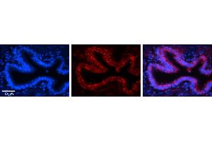 Rabbit Anti-RPLP0 Antibody     Formalin Fixed Paraffin Embedded Tissue: Human Bronchial Epithelial Tissue  Observed Staining: Cytoplasmic  Primary Antibody Concentration: 1:100  Secondary Antibody: Donkey anti-Rabbit-Cy3  Secondary Antibody Concentration: 1:200  Magnification: 20X  Exposure Time: 0. (RPLP0 抗体  (N-Term))