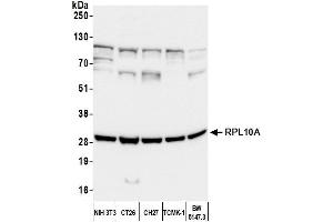 Western Blotting (WB) image for anti-Ribosomal Protein L10a (RPL10A) (AA 50-100) antibody (ABIN7450674) (RPL10A 抗体  (AA 50-100))
