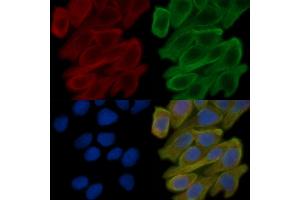 ABIN6258746 and ABIN6273920 staining Hela cells(30 min of UV treatment) by IF/ICC. (FZD10 抗体  (Internal Region))