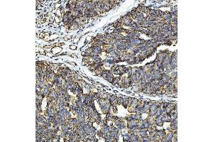 IHC analysis of GPCR RDC1/CXCR-7/ACKR3 using anti-GPCR RDC1/CXCR-7/ACKR3 antibody (ABIN7602889). (CXCR7 抗体  (C-Term))