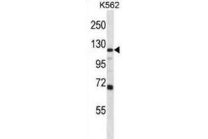 Western Blotting (WB) image for anti-Glutamate Receptor, Ionotropic, AMPA 4 (GRIA4) antibody (ABIN2997039) (GRIA4 抗体)
