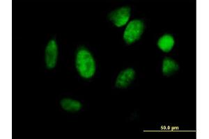 Immunofluorescence (IF) image for anti-Inhibitor of DNA Binding 1, Dominant Negative Helix-Loop-Helix Protein (ID1) (AA 1-155) antibody (ABIN516782)