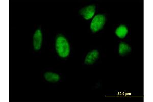 Immunofluorescence of purified MaxPab antibody to ID1 on HeLa cell. (ID1 抗体  (AA 1-155))