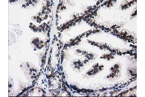 Immunohistochemical staining of paraffin-embedded Human prostate tissue using anti-ACY3 mouse monoclonal antibody. (Aminoacylase 3 抗体)