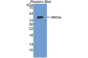 Western blot analysis of the recombinant protein. (IL-6 Receptor 抗体  (AA 19-348))
