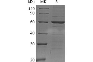 Greater than 95 % as determined by reducing SDS-PAGE. (IRF5 Protein (His tag))