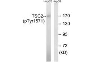 Western Blotting (WB) image for anti-Tuberous Sclerosis 2 (TSC2) (AA 1537-1586), (pTyr1571) antibody (ABIN482799) (Tuberin 抗体  (pTyr1571))