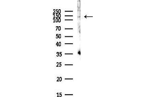 Western blot analysis of lysates from PC12 cells(LPS,4h treatment), using Phospho-NFAT3 (Ser676) Antibody at 1/1000 dilution.
