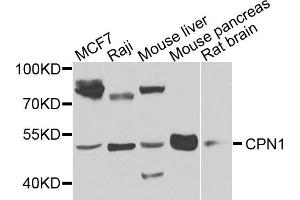 Western blot analysis of extracts of various cells, using CPN1 antibody. (CPN1 抗体)