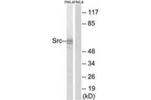 Western blot analysis of extracts from HeLa cells, using Src (Ab-529) Antibody. (Src 抗体  (AA 487-536))