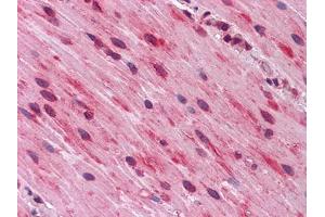 Immunohistochemical analysis of paraffin-embedded human Small Intestine, muscularis propria tissues using anti-GATA3 mouse mAb (GATA3 抗体)