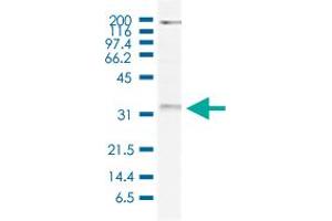 Western Blot (Cell lysate) analysis of 20 ug nuclear extracts of HeLa cells. (WDR61 抗体)