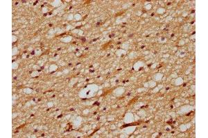 IHC image of ABIN7149649 diluted at 1:700 and staining in paraffin-embedded human brain tissue performed on a Leica BondTM system. (DLL3 抗体  (AA 27-492))