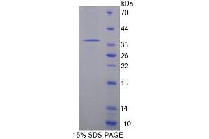 SDS-PAGE analysis of Mouse ACADM Protein. (Acyl-CoA Dehydrogenase, C-4 To C-12 Straight Chain (ACADM) 蛋白)