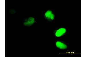 Immunofluorescence of monoclonal antibody to FRG1 on HeLa cell. (FRG1 抗体  (AA 1-258))