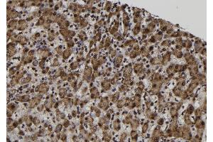 ABIN6272510 at 1/100 staining Human liver tissue by IHC-P. (MAGAC 抗体)
