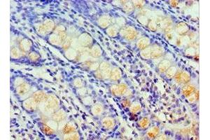 Immunohistochemistry (IHC) image for anti-Histidyl-tRNA Synthetase (HARS1) (AA 1-180) antibody (ABIN7155257)