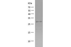Western Blotting (WB) image for Mitochondrial Antiviral Signaling Protein (MAVS) (AA 237-513) protein (His tag) (ABIN7123973) (MAVS Protein (AA 237-513) (His tag))