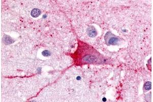 Anti-TRH Receptor antibody  ABIN1049426 IHC staining of human brain, neurons and glia. (TRHR 抗体  (Cytoplasmic Domain))