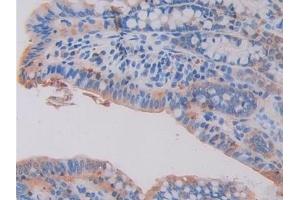 Detection of HEXb in Mouse Small intestine Tissue using Polyclonal Antibody to Hexosaminidase B Beta (HEXb)