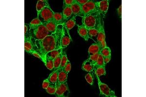 Immunofluorescence (IF) image for anti-Glypican 3 (GPC3) antibody (ABIN6939528)