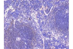 IHC analysis of PCDH15 using anti-PCDH15 antibody (ABIN6719362).