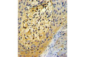 Formalin-fixed and paraffin-embedded human skin tissue reacted with SPARC Antibody , which was peroxidase-conjugated to the secondary antibody, followed by DAB staining. (SPARC 抗体  (C-Term))