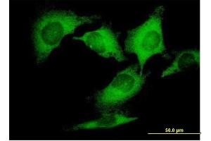 Immunofluorescence of purified MaxPab antibody to DCTN2 on HeLa cell. (Dynamitin 抗体  (AA 1-401))