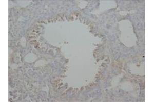 Immunohistochemical analysis of Paraffin-Embedded Rat Tissue Sections (Lung) using RAGE antibody. (RAGE 抗体  (Middle Region))
