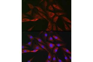 Immunofluorescence analysis of NIH/3T3 cells using SOCS3 Rabbit pAb (ABIN3021099, ABIN3021100, ABIN3021101 and ABIN6213950) at dilution of 1:50 (40x lens). (SOCS3 抗体  (C-Term))