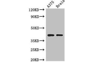 Western Blot Positive WB detected in: A375 whole cell lysate, Mouse brain tissue All lanes: SEPT12 antibody at 3. (Septin 12 抗体  (AA 1-358))