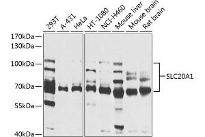 Western blot analysis of extracts of various cell lines, using SLC20 antibody (ABIN1682754, ABIN3018562, ABIN3018563 and ABIN6220499) at 1:1000 dilution. (SLC20A1 抗体  (AA 257-356))