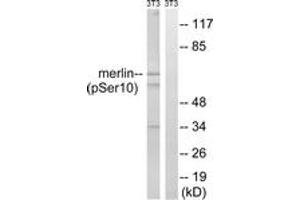 Western blot analysis of extracts from NIH-3T3 cells treated with IFN 2500U/ml 30', using Merlin (Phospho-Ser10) Antibody. (Merlin 抗体  (pSer10))
