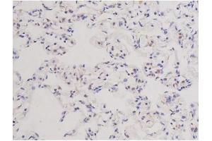 ABIN6266578 at 1/200 staining Rat lung tissue sections by IHC-P. (Ki-67 抗体  (Internal Region))