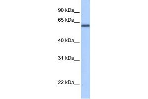 WB Suggested Anti-ZNF417 Antibody Titration:  0. (ZNF417 抗体  (N-Term))