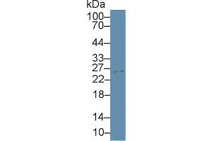 Western Blot; Sample: Mouse Cerebrum lysate; ;Primary Ab: 3µg/ml Rabbit Anti-Mouse TIMP4 Antibody;Second Ab: 0. (TIMP4 抗体  (AA 42-224))