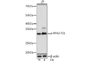 Western blot analysis of extracts of C6 cells, using Phospho-RP-T21 Rabbit mAb (ABIN7269916) at 1:1000 dilution. (RPA2 抗体  (pThr21))