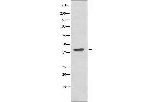 Western blot analysis of extracts from A549 cells, using TISD antibody. (ZFP36L2 抗体  (Internal Region))
