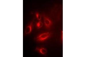 Immunofluorescent analysis of TPMT staining in U2OS cells. (TPMT 抗体)