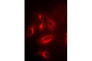 Immunofluorescent analysis of TPMT staining in U2OS cells.