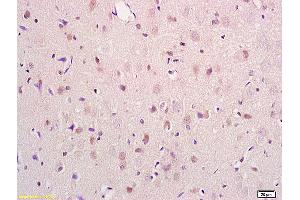 Formalin-fixed and paraffin embedded mouse kidney tissue labeled with Anti PRODH Polyclonal Antibody,Unconjugated (ABIN715136) at 1:200 followed by conjugation to the secondary antibody and DAB staining. (PRODH 抗体  (AA 141-240))