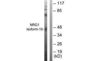 Western blot analysis of extracts from SKOV3 cells, using NRG1 isoform-10 antibody. (Neuregulin 1 抗体  (Isoform 10))